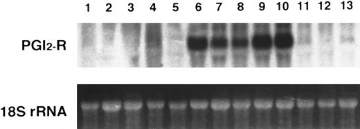 Fig. 1. Northern blot analysis of PGI2-R mRNA in human hematopoietic cell lines. A total of 20 μg of total RNA from respective cell lines was electrophoresed in 1.5 % agarose-formaldehyde gel and hybridized with 1.9 kb EcoRI fragment of phIPR1 for PGI2-R cDNA. The 18S ribosomal RNA was used as the internal control. Lane 1, MOLT4; lane 2, MM-S1; lane 3, U266; lane 4, THP-1; lane 5, HL60; lane 6, KU812; lane 7, HEL; lane 8, NS-Meg; lane 9, CMK11-5; lane 10, CMK; lane 11, Meg-01; lane 12, K562; lane 13, JK-1. The experiment is representative of three performed.