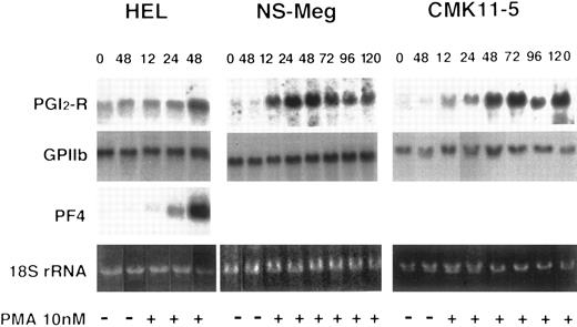 Fig. 2. Effect of PMA on the expression of PGI2-R, PF4, and GPIIb mRNA in HEL, NS-Meg, and CMK11-5 cells. PMA was added at the initiation of culture and cells harvested at the indicated times were examined by Northern analysis. The figure shows the representative results from triplicate experiments repeated twice. PMA enhanced PGI2-R expression in all of these cell lines. The time and intensity of maximum PGI2-R expression was as follows: HEL, 48 hours (threefold), NS-Meg, 48 hours (fivefold), and CMK11-5, 72 hours (eightfold). PMA enhanced the expression of GPIIb mRNA in these cell lines and that of PF4 mRNA in HEL cells. The controls were the cells cultured without PMA. They yielded no enhancement of PGI2-R for the entire culture periods except a little enhancement in HEL at 48 hours (48-hour controls are shown). All of the PMA-stimulated expressions were significantly different from respective control expressions in all of these cell lines (P < .01).
