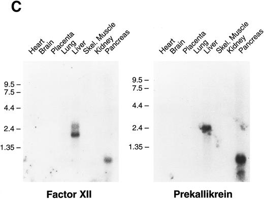 Fig. 6. Northern blots of human and murine tissues for factor XI and contact activation protease expression. (A) Human tissue Northern blots hybridized with a full-length human factor XI cDNA probe, (B) murine tissue Northern blots hybridized with a full-length murine factor XI cDNA probe, and (C) human tissue Northern blots hybridized with either a full-length human factor XII or human prekallikrein cDNA probe. Blots were subsequently stripped and hybridized with a human β-actin cDNA probe to show equal lane loading of RNA. The position of molecular weight markers in kilobases is shown at the left of the figures.