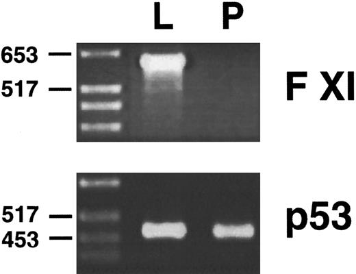 Fig. 7. Reverse transcription/PCR analysis of murine liver and pancreas for factor XI expression. PolyA RNA from liver (L) and pancreas (P) were reverse transcribed as described in Materials and Methods, followed by PCR with oligonucleotides specific for the murine factor XI or murine p53 cDNAs. PCR products were size fractionated on a 2.0% agarose gel followed by staining with ethidium bromide. The position of molecular weight markers in DNA kilobases is shown at the left of the figure.