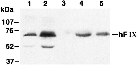 Fig. 3. Western blot analysis of hFIX. Lane 1, medium of myotubes carrying LIXSN; lane 2, medium of myotubes carrying pdLMe4βAhIXm1; lane 3, medium of myotubes carrying BAG; lane 4, hFIX precipitated from pooled normal human plasma; and lane 5, recombinant hFIX (100 ng). Numbers on the left indicate the molecular size markers. The hFIX band position is shown on the right. Protein bands with an approximate size of 52 kD in lanes 1 and 2 may correspond to degradation products of hFIX during the protein preparation procedure.