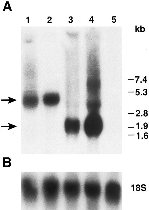 Fig. 5. Northern blot analysis of hFIX expressed by myoblasts and myotubes. (A) Total cellular RNAs prepared from cells on day 2 (myoblasts) and day 5 (myotubes) in Fig 4 were subjected to Northern blot analysis. Lanes 1 and 2: myoblasts (day 2) and myotubes (day 5) carrying LIXSN, respectively. Lanes 3 and 4: myoblasts (day 2) and myotubes (day 5) carrying pdLMe4βAhIXm1, respectively. Three major bands are seen in lane 4; they are transcription products from LTR and Me4βA, respectively, corresponding to the predicted mRNA size shown in Fig 1. Lane 5: total RNAs prepared from untransfected myotubes. Numbers on the right indicate the RNA molecular size markers and arrows on the left indicate the major hFIX mRNA bands. (B) Hybridization of the same filter membrane with 18S ribosome RNA probe after the dehybridization of the hFIX probe as RNA loading controls.