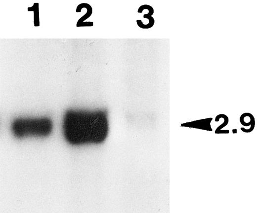 Fig. 9. Southern blot analysis of the genomic DNAs prepared from the leg muscle tissues of tumor-bearing animal. Aliquots of the total genomic DNA samples (10 μg) prepared from the leg tissues of a tumor-bearing animal were digested with BamHI, and subjected to Southern blot analysis (see the Materials and Methods). The unique human factor IX transgene bands detected (2.9 kb in size as marked on the right side) were quantified with PhosphorImager. Lane 1, DNA from the right hind leg with tumor; lane 2, DNA from the left leg with no tumor; lane 3, control DNA of primary myoblasts transduced with BAG (β-galactosidase retrovirus).