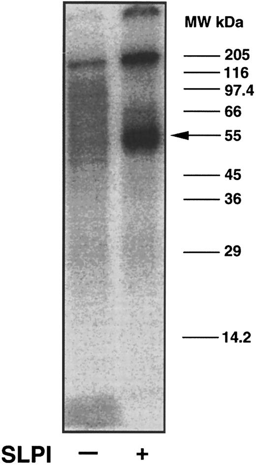 Fig. 4. Coprecipitation of SLPI binding proteins from monocytes using anti-SLPI antibodies. Intact monocytes were surfaced-labeled with Na125I. Radioiodinated cells were lysed in 0.5% NP40, and lysate was added to immobilized anti-SLPI antibodies in the presence or absence of SLPI. Proteins binding to the antibodies were eluted using 50 mmol/L glycine, pH 2.5, and 0.15% NP40. Eluted proteins were assayed by PAGE on a 12% gel under nonreducing conditions. The gel was dried and an autoradiogram was made. A major radioiodinated band coprecipitating with SLPI migrated at 55 ± kD (arrow), whereas the same protein did not bind to the antibodies in the absence of SLPI.
