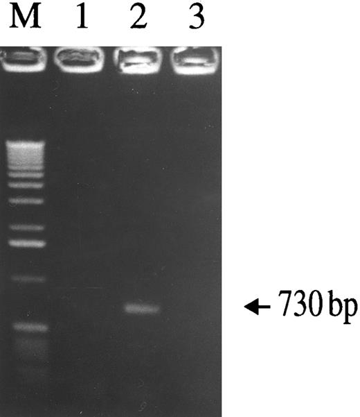 Fig. 8. Assay of nascent viral DNA synthesis in monocytes with or without SLPI treatment. Adherent monocytes were infected with HIV-1Ba-L for 2.5 hours, washed extensively, trypsinized to remove loosely bound virus particles, and then incubated for 18 hours. Cellular lysates were prepared and assayed for the presence of viral DNA using a nested-PCR–based assay. A 730-bp HIV-1–specific PCR product was detected in virus-infected cells (lane 2), but not in uninfected cells (lane 1). In the presence of 5 μg/mL SLPI, no virus-specific PCR product was generated (lane 3), indicating SLPI-mediated inhibition of viral DNA formation. Equivalent amounts of cellular DNA per sample were analyzed as indicated by PCR amplification using β-globin–specific primers (data not shown).