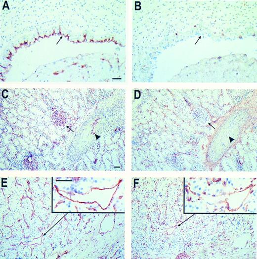 Fig. 2. Immunohistochemical peroxidase staining of CD44 on normal tissue and RCC associated EC. Frozen tissue sections of human umbilical vein (A and B), normal renal tissue (C and D), and RCC (E and F ) were stained for EC-marker EN4 (A, C, and E) and CD44 (NKI-P1 antibody, B, D, and F ). The arrows in (A and B) identify the EC layer. In (C and D) the arrows identify the glomeruli and the arrowheads mark the EC in the larger vessels. From the RCC sections one vessel is magnified (insets). Bars represent 50 μm, in (A) for (A and B), in (C) for (C through F ), insets same magnitude.
