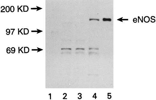 Fig. 1. Expression of eNOS enzyme in transfected U937 cells. Western blot with a monoclonal antibody against human endothelial NOS (eNOS) is shown. Lanes are numbered as follows: (1) M.W. markers; (2) untransfected U937 cells; (3) U937 cells transfected with the pCEP4 vector without the eNOS gene; (4) U937 cells transfected with the pCEP4 vector containing the eNOS gene; (5) human endothelial cell lysate (positive control).