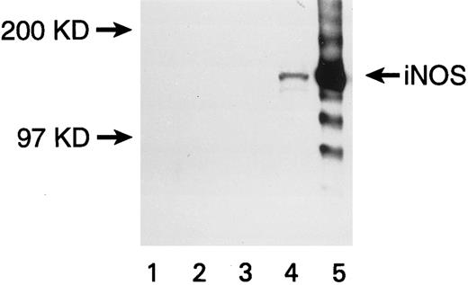 Fig. 2. Expression of iNOS enzyme in transfected U937 cells. Western blot with a monoclonal antibody against mouse macrophage inducible NOS (iNOS) is shown. Lanes are numbered as follows: (1) M.W. markers; (2) untransfected U937 cells; (3) U937 cells transfected with the pCEP4 vector without the iNOS gene; (4) U937 cells transfected with the pCEP4 vector containing the iNOS gene; (5) lysate from murine macrophage RAW 264.7 cells induced with LPS and IFN-γ (positive control).