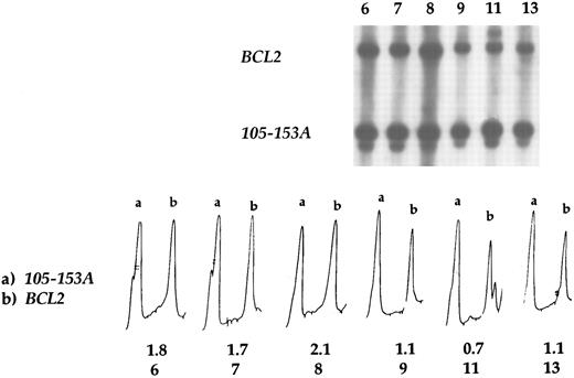 Fig. 3. BCL2 amplification by Southern blot hybridization. In case nos. 6, 7, and 8 BCL2 amplification was detected, whereas tumors 9, 11, and 13 displayed no amplification. Case no. 9 is the t(14; 18) positive case as well as the case no. 11, in which the translocation occurred in the MBR region. Case no. 13 had a normal chromosome 18. Densitometric profiles show the amplification of BCL2 (b) in the first three cases, in which the signal intensity ratio varied from 1.7 to 2.1, whereas in the other cases it varied from 0.7 to 1.1. Probe 105-153A was used as a control, and the peak (a) corresponds to its intensity.
