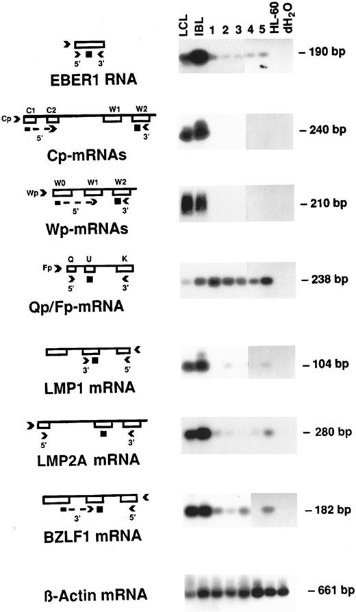 Fig. 2. RT-PCR for EBV latent transcripts. RNA samples were subjected to RT reaction, then cDNA was amplified with the appropriate primers for each latent gene region. The PCR products were hybridized to a 32P-labeled internal oligonucleotide probe. LCL was used as positive control; IBL was used as an additional control because of its similarities to PELs. HL60 is a promyelocytic cell line used as negative control; H2O represents reactions carried out in the absence of cDNA. The number above each lane corresponds to the PEL case. Diagrams on the left illustrate the corresponding transcripts, with arrows indicating primers and small black squares representing the probes used. β-Actin was used as a control for equal amounts of mRNA used for the RT-PCR reaction.