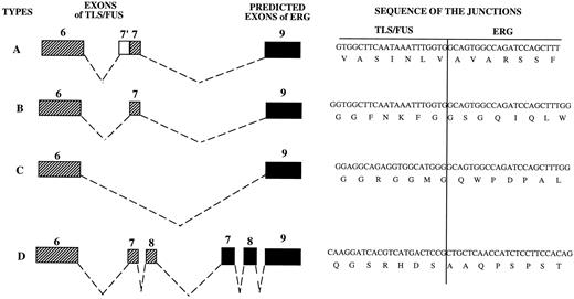 Fig. 4. Four different TLS/FUS-ERG junctions are schematically depicted, and their sequences are indicated. (▨) Denote TLS/FUS exon sequence, (▪) represent ERG exon sequence, and an (□) (7′) indicates the sequence resulting from the possible alternative splicing of TLS/FUS intron 6. Numbers above boxes indicate the exon number of each gene. Vertical lines indicate the nucleotide position of the junction between the two genes. The types of these four transcripts are indicated in the left margin. The junction of type D was first reported here. Additional 3 exons of TLS/FUS exon 8 and ERG exons 7 and 8 are included in the junction position of type B to form a new fusion transcript, type D. Types B and D had in-frame junctions, and types A and C had out-of-frame junctions.