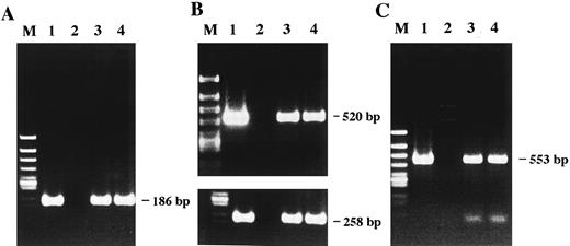 Fig. 3. Detection of HHV-6 DNA by PCR amplification. The amplified products were subjected to electrophoresis and stained with ethidium bromide. (A) The 186-bp product amplified with primer pair 1 is seen in lanes 1, 3, and 4. (B) A nested PCR assay. A first round of amplification with primer pair 2 generated a 520-bp product seen in lanes 1, 3, and 4. A second round of amplification that was performed with nested primer pair 2′ and one-hundredth of the products of the first round of amplification generated a 258-bp product. (C) Variant determination of HHV-6 by PCR. Generation of a 553-bp product by PCR with primer pair 3 indicates the presence of HHV-6 variant B. The PCR products detected were all of the predicted sizes based on previous reports. Lane 1, HHV-6B–infected MT-4 cells as a positive control; lane 2, Akata cells as a negative control; lane 3, patient's original lymphoma cells; lane 4, Katata cells; lane M, φX174/HincII-cut DNA size marker.
