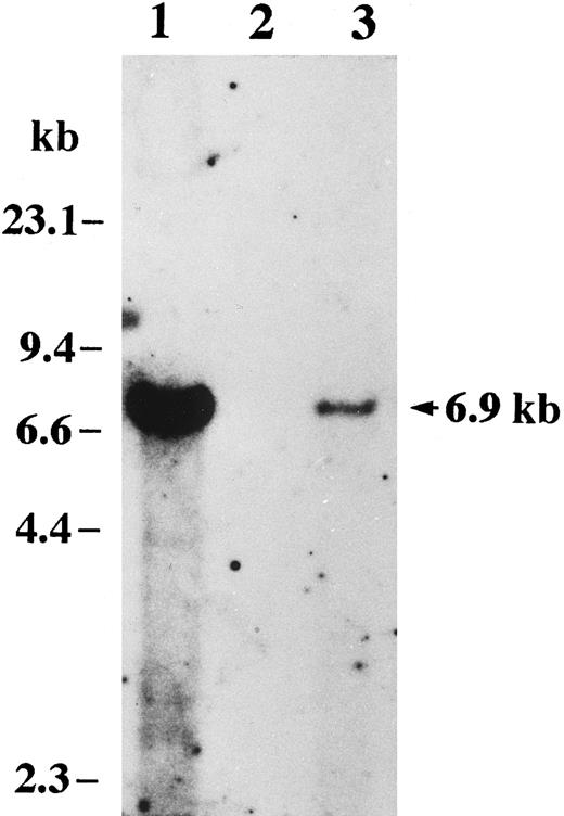 Fig. 4. Detection of HHV-6 DNA by Southern blot analysis. Total cellular DNAs were digested with BamHI, subjected to electrophoresis through a 0.75% agarose gel, transferred onto a nylon-membrane filter, and hybridized with the 32P-labeled BamHI fragment of HHV-6 DNA. A hybridizaion band at 6.9 kb is seen in lanes 1 and 3. Positions of size markers are shown on the left. Lane 1, HHV-6–infected MT-4 cells; lane 2, Akata cells; lane 3, Katata cells.