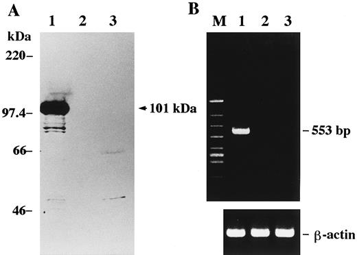 Fig. 5. (A) Western blot analysis for detection of virion-associated antigen of HHV-6. Proteins were subjected to SDS-polyacrylamide gel electrophoresis and transferred onto a nitrocellulose filter. The proteins were reacted with a monoclonal antibody C3 108-103, followed by incubation with peroxidase-labeled antimouse antibody. The blots were developed by the enhanced chemiluminescence method. A 101-kD band is seen in lane 1. Positions of weight markers are indicated on the left. (B) RT-PCR analysis for detection of the immediate-early gene transcript of HHV-6. Isolated RNAs were used for cDNA synthesis and the cDNAs were PCR-amplified with primer pair 3 in the region corresponding to the immediate-early gene. The expected product of 553 bp is seen in lane 1. All cDNAs were subjected in parallel to amplification of the housekeeping gene β-actin, which was expressed at a comparable amount in all samples. Lane 1, HHV-6–infected MT-4 cells; lane 2, Akata cells; lane 3, Katata cells; lane M, φX174/ HincII-cut DNA size marker.