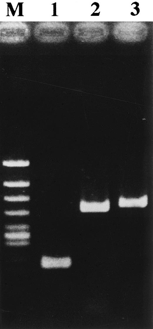 Fig. 6. Detection of HHV-6 DNA in the nude mouse tumor. HHV-6 DNA was detected by PCR with each primer set. Lane 1, primer pair 1; lane 2, primer pair 2; lane 3, primer pair 3; lane M, φX174/HincII-cut DNA size marker.