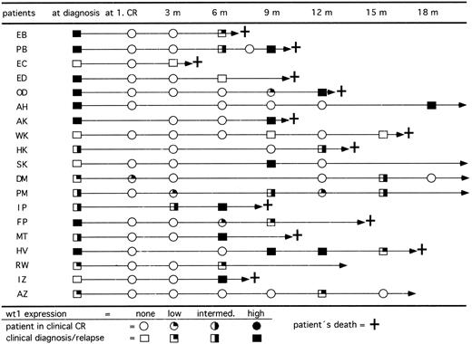 Fig. 5. Follow-up of RT-PCR products for wt1 in 19 patients who relapsed after achieving clinical CR. Fourteen of 15 patients initially wt1 positive reexpressed wt1 mRNA in relapse and 2 of 4 patients initially wt1 negative became wt1 positive in relapse. Patients SK and AZ relapsed and achieved a second CR by reinduction therapy.