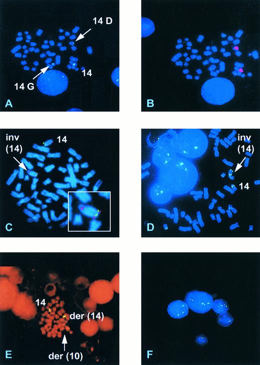 Fig. 2. Representative FISH analyses with the 14q11/TCRα/δ YAC and the 14q32/IgH cosmid. (A) Case Deb showing hybridization of a TCRα/δ YAC to the normal chromosome 14, a G group size chromosome (14G), and a D group size chromosome (14D). (B) The same mitosis as (A) rehybridized with a chromosome 14 paint. (C) Case Gam hybridized with the YAC (red) and the IgH Ig10 cosmid (green) showing a normal chromosome 14 and the presence of an inversion (arrow) with a breakpoint within 14q32 proximal to the IgH locus. (D) Case UPN 957 showing the presence of an inv(14). (E) Case UPN 282 showing hybridization of the TCRα/δ YAC to the normal chromosome 14, a der(14) and a der(10). (F ) Interphase nuclei from UPN 282 showing the presence of three hybridization signals in three of the five nuclei.