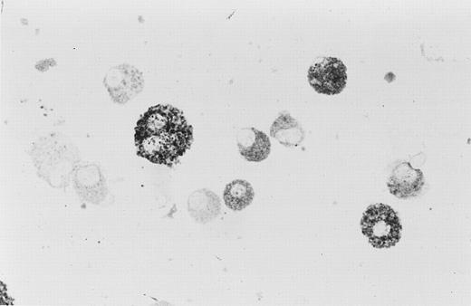 Fig. 2. Bronchoalveolar macrophages, sorted for high auto-fluorescence, were stained for NAMLAA. Twenty percent of the macrophages stained positive.