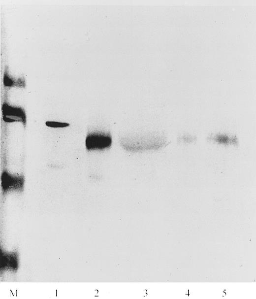 Fig. 7. Western blot of neutrophil cell fractions. Lane M corresponds to prestained molecular weight markers of 116, 80, 49, and 32 kD. Lane 1 corresponds to purified NAMLAA from human plasma. Lanes 2, 3, 4, and 5 correspond to the azurophilic granule–containing fraction, the cytosol fraction, the specific granule–containing fraction, and the purified plasma membrane fraction, respectively. Only the azurophilic granule–containing fraction and the membrane fraction were recognized by MoAb AAA4, producing a band with a lower molecular mass than the NAMLAA purified from plasma in lane 1.