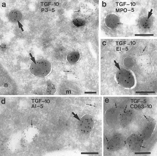 Fig. 5. Characterization of the TGF-α–positive granules in monocytes. Monocytes of the peripheral blood were double-labeled for TGF-α and for several components of the granules and vesicles, respectively. In (a) through (c), it is shown that TGF-α is localized in granules other than proteinase-3 (P-3), myeloperoxidase (MPO), and elastase (EL), markers of the peroxidase-positive granules of the monocyte. (d) No colocalization with albumin (AL), marker for a secretory compartment. (e) Colocalization with CD63, a membrane-bound glycoprotein. Bars = 200 nm