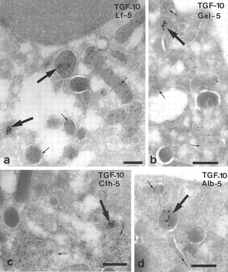 Fig. 7. Characterization of the TGF-α–positive granules in neutrophils from peripheral blood by double-labeling. (a) TGF-α (large arrows) does not colocalize with lactoferrin (Lf ) (small arrows), a marker of neutrophil specific granules. (b) No colocalization with gelatinase (Gel), a marker of gelatinase-granules. (c) TGF-α (large arrow) is detected in a compartment other than cathepsin G (Cth) (small arrows), which is present in azurophil granules. (d) TGF-α (large arrow) is detected in a compartment other than albumin (Alb) (small arrows) of secretory vesicles. Bars = 200 nm.