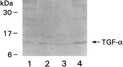 Fig. 8. Western blot showing immunoreactive TGF-α. Monocytes were purified from four different donors, the denatured proteins from the cell extracts were run on gels, transferred to nitrocellulose membrane, and detected by MoAb to TGF-α and secondary alkaline phosphatase-conjugated goat antimouse antibody. The positions of the molecular weight markers are on the left.