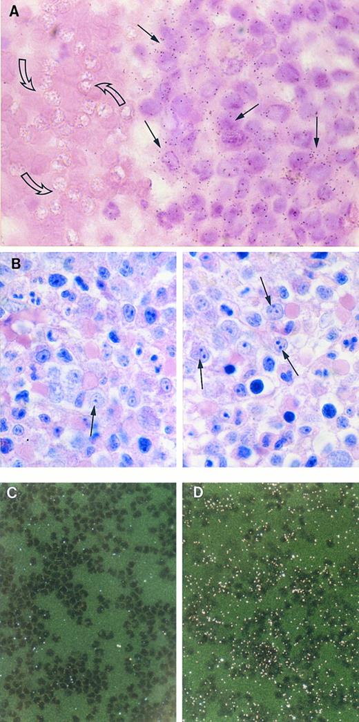 Fig. 9. Detection of TGF-α mRNA in bone marrow and peripheral blood monocytes by in situ hybridization. (A) Bright-field photomicrograph of a section of bone marrow from a patient with myelodysplastic syndrome hybridized with 32S-labeled antisense RNA for TGF-α and stained with hematoxylin and eosin. Positive signal for TGF-α is seen in numerous monocytoid cells (closed arrows), but not in the red blood cells (open arrows). Autoradiography was for 30 days. (×1,000). (B) Wright-Giemsa stained section of a surrounding region of the bone marrow. Monocytoid cells (arrows) are abundant in this area (×100). (C) and (D) Dark-field photomicrographs of circulating monocytes, prepared as described in Materials and Methods. There is no autoradiographic signal for TGF-α mRNA (C), whereas specific signal appearing as bright dots under dark-field microscopy, was evident for β-actin mRNA (D). Autoradiography was for 32 days. (×256).