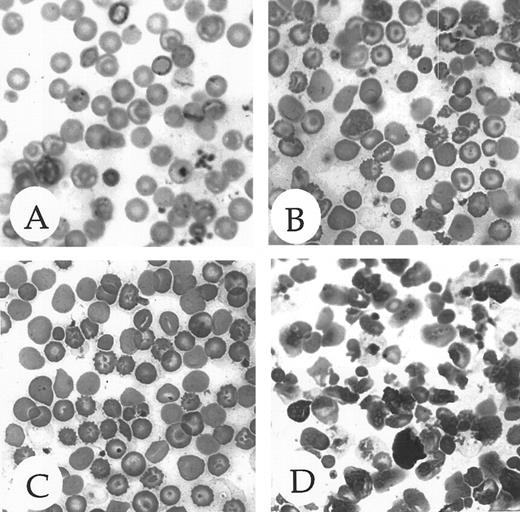 Fig. 4. Peripheral blood morphology of homozygous ζ- and α1-null adult mice. (A) Blood from a mouse with wild-type globin genes on an outbred 129/Black Swiss genetic background demonstrating normal erythrocyte morphology. (B) Blood from a mouse with a ζ−/− null genotype on an outbred 129/Black Swiss genetic background demonstrating abnormal red cell morphology. (C) Blood from a mouse with a α1−/− null genotype on an outbred 129/Black Swiss genetic background demonstrating mildly abnormal red cell morphology. (D) Blood from a mouse with an α1−/− null genotype on an inbred 129 genetic background displaying severe anisopoikilocytosis and highly abnormal red blood cell morphology. A more detailed description of the red cell morphology is given in the text.