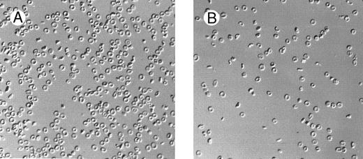 Fig. 1. Effect of dietary Mg on erythrocyte morphology. Red blood cell morphology in β thal mice following 28 days of high-Mg diet (A) and low-Mg diet (B).