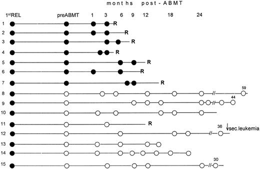 Fig. 1. Longitudinal RT-PCR monitoring of the PML/RARα fusion gene in BM samples collected before and after ABMT. Following RT-PCR characterization of relapse, all pretransplantation (pre-ABMT) and posttransplantation (post-ABMT) tests were performed while patients were in hematologic remission. Black and white circles indicate positive and negative RT-PCR tests, respectively. 1st REL, first relapse; R, hematologic relapse; ↓ sec. leukemia, this patient developed at 36 months a secondary (or therapy-related) leukemia whose blasts tested RT-PCR− for the PML/RARα hybrid. Numbers above the white (open) circles indicate the last follow-up control, in months, after achievement of second remission.