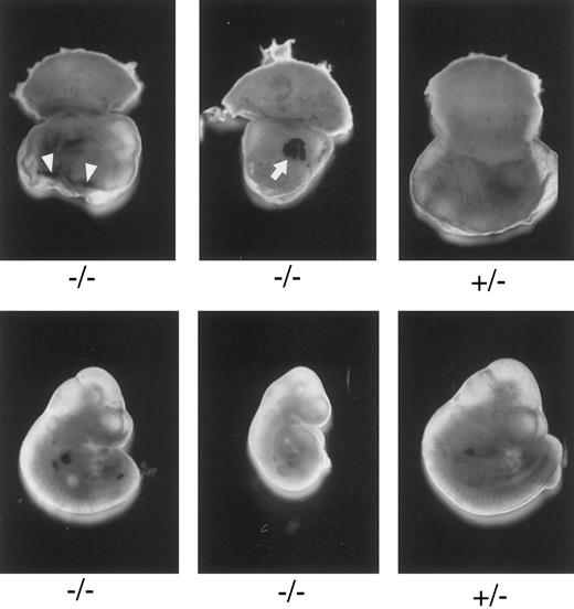 Fig. 2. Macroscopic examination of E10.3 embryos. TFPIK1 genotypes are indicated. Arrowheads, intra-yolk sac hemorrhage with red blood cells in yolk sac folds; arrow, blood “lakes” in yolk sac. Note that yolk sac hemorrhage can be found with a near normal embryo (left, bottom), suggesting that hemorrhage and concomitant circulatory collapse precede the wasting and ultimate death of the embryo.
