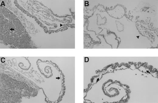 Fig. 3. Microscopic examination of yolk sac and placenta of E10.5 TFPIK1(−/−) embryos. (A) Normal-appearing placenta and yolk sac from a normal appearing embryo. Nucleated embryonic erythrocytes are present in placenta (arrow) and yolk sac (arrowhead) vessels. (B) Yolk sac of a severely growth and developmentally retarded embryo displaying disruption and degeneration of yolk sac tissues. Arrowhead denotes blood cells within a broad space between endoderm and mesoderm layers, perhaps the microscopic equivalent of a macroscopic blood “lake” (Fig 2). (C) Placenta and yolk sac of modestly growth retarded embryo. Note lack of nucleated erythrocytes in placenta and yolk sac vasculature and the lateral expansion of yolk sac vessels (arrow). (D) Higher magnification of yolk sac shown in (C). Arrows point to thin acellular septae connecting the endodermal and mesodermal layers.