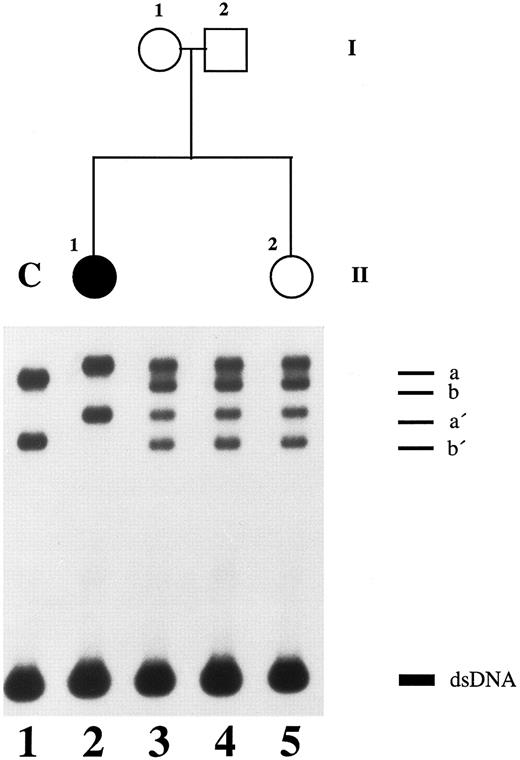 Fig. 2. SSCP analysis of plasminogen gene exon 7 in patient 1, her healthy parents, and her healthy sister. Radiolabeled single-stranded PCR products of plasminogen exon 7 were electrophoresed in a nondenaturing 5% polyacrylamide gel as described in Materials and Methods. Lane 1, healthy control (C); lane 2, patient 1 with ligneous conjunctivitis (II-1); lane 3, healthy mother of patient 1 (I-1); lane 4, healthy father of patient 1 (I-2); lane 5, healthy sister of patient 1 (II-2). dsDNA, double-stranded DNA.