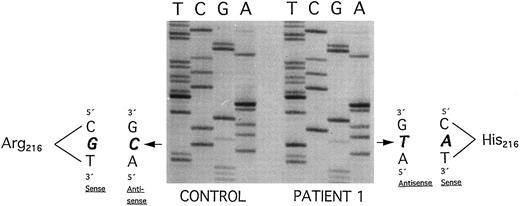Fig. 4. Plasminogen exon 7 sequence analysis in family 1 (noncoding strand is shown in the autoradiography). Single-stranded DNA fragments with a variant migration pattern in SSCP analysis (Fig 2, bands a, a′, b, b′) were excised from polyacrylamide gel and sequenced as described in Materials and Methods. The DNA of patient 1 with ligneous conjunctivitis exhibited a homozygous point mutation (G → A) at position 780, leading to an amino acid exchange at position 216 (Arg216 → His) (right). The healthy sister and the healthy parents (Fig 2, II-1, I-1, and I-2) are heterozygous for this mutation. Sequencing of band b and b′ exhibited the wild-type sequence (left; CONTROL). Numbering of nucleotides and amino acids is rendered according to Forsgren et al52 and Petersen et al,21 respectively.