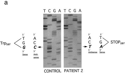 Fig. 6. (a) Plasminogen exon 15 sequence analysis in family 2 (noncoding strand is shown). Single-stranded DNA fragments with a variant migration pattern in SSCP analysis (Fig 3, bands a, b, and c) were excised from polyacrylamide gel and sequenced as described in Materials and Methods. The DNA of the patient 2 (band a in Fig 3) exhibited a homozygous point mutation (G → A) at position 1924, leading to a stop codon at position 597 (Trp597 → STOP). The mother and the father (Fig 3, I-1 and I-2) are heterozygous for this mutation. Numbering of nucleotides and amino acids is rendered according to Forsgren et al52 and Petersen et al,21 respectively. (b) The second allele of the father (band b) contained a point mutation (G → C) at position 1924, leading to an amino acid exchange (Trp597 → Cys597 ). Numbering of nucleotides and amino acids is rendered according to Forsgren et al52 and Petersen et al,21 respectively.
