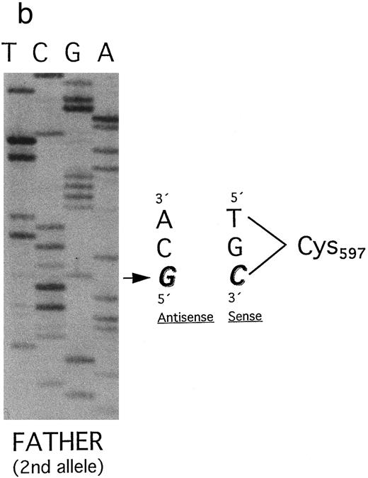 Fig. 6. (a) Plasminogen exon 15 sequence analysis in family 2 (noncoding strand is shown). Single-stranded DNA fragments with a variant migration pattern in SSCP analysis (Fig 3, bands a, b, and c) were excised from polyacrylamide gel and sequenced as described in Materials and Methods. The DNA of the patient 2 (band a in Fig 3) exhibited a homozygous point mutation (G → A) at position 1924, leading to a stop codon at position 597 (Trp597 → STOP). The mother and the father (Fig 3, I-1 and I-2) are heterozygous for this mutation. Numbering of nucleotides and amino acids is rendered according to Forsgren et al52 and Petersen et al,21 respectively. (b) The second allele of the father (band b) contained a point mutation (G → C) at position 1924, leading to an amino acid exchange (Trp597 → Cys597 ). Numbering of nucleotides and amino acids is rendered according to Forsgren et al52 and Petersen et al,21 respectively.