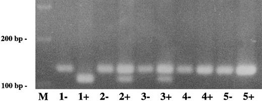 Fig. 7. Direct detection of plasminogen mutation in family 2 by amplification mutagenesis. A part of plasminogen exon 15 containing the stop codon mutation (G → A) at position 1924) was amplified by PCR as described in Materials and Methods. The reverse primer has a single sequence mismatch that results in the introduction of an artificial Hinf I restriction site into the mutant exon 15 allele only. Amplified PCR products were digested with Hinf I and electrophoresed in a 2.5% agarose gel and visualized by ethidium bromide staining. The mutant Hinf I-digested PCR fragment has a size of 107 bp, the wild-type (uncut) PCR fragment has a size of 129 bp. −, No Hinf I added to PCR product; +, Hinf I added to PCR product. Lane M, 100-bp ladder; lane 1, patient 2; lane 2, mother of patient 2; lane 3, father of patient 2; lane 4, healthy sister of patient 2; lane 5, healthy control. The (shorter) mutant Hinf I-digested allele is found in patient 1 (lane 1+) and the parents (lanes 2+ and 3+, heterozygotes), but not in the sister (lane 4+) and the healthy control (lane 5+).