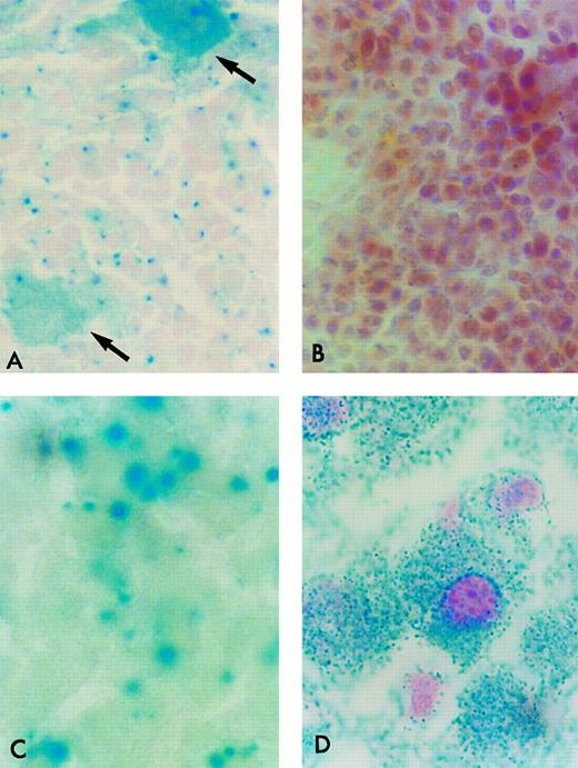 Fig. 1. β-Gal Histochemical staining of cryostat sections of tissues from ROSA 26 animals. Frozen sections of tissues were incubated in the presence of X-gal and counterstained with safranin-O. All nucleated ROSA 26 BM cells stain blue, indicating the presence of β-gal activity (A). Most ROSA 26 cells stain with a bright blue perinuclear area. Other cells, such as the megakaryocyte (open arrow) stain with a more diffuse pattern. No cells in the control B6/129 F2 marrow stain blue, indicating the absence of β-gal activity (B). All nucleated cells in the adult ROSA 26 brain (C) and liver (D) also stain blue demonstrating β-gal activity. (B) is counterstained more intensely to allow the identification of individual cells.