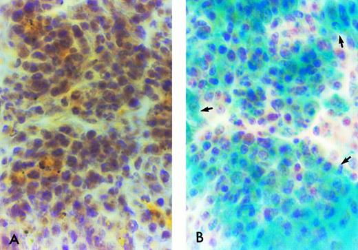 Fig. 4. β-Gal histochemical staining of cryostat sections of spleens from B6/129 F2 animals 1 month after transplantation with ROSA 26 or B6/129 F2 BM. None of the cells in the spleen of a B6/129 F2 mouse transplanted with control B6/129 F2 marrow stain blue indicating the absence of β-gal activity (A). Nearly all cells in the spleen of a B6/129 F2 animal transplanted with ROSA 26 marrow stain blue indicating engraftment with β-gal expressing ROSA 26 BM (B). Some positive cells are highlighted by arrows.