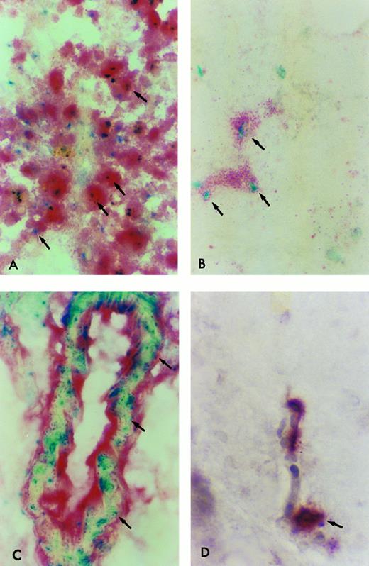 Fig. 6. β-Gal expressing tissue macrophage and microglia engraftment in B6/129F2 animals 1 year after transplantation. Cryostat sections of spleen, lung, liver, and brain from B6/129 F2 animals transplanted with ROSA 26 BM were histochemically stained blue to demonstrate the presence of β-gal expressing ROSA 26 origin cells followed by immunocytochemical staining red with the antibodies F4/80 and M1/70 directed against mouse macrophage markers. Double-positive cells (arrows) are shown in the spleen (A), lung (B), and perivascular areas of the brain (C). Only rare double-positive cells are found in the parenchyma of the brain (D). All double-positive cells in (B) and (D) are indicated by arrows. Some double-positive cells in (A) and (C) are highlighted by arrows.