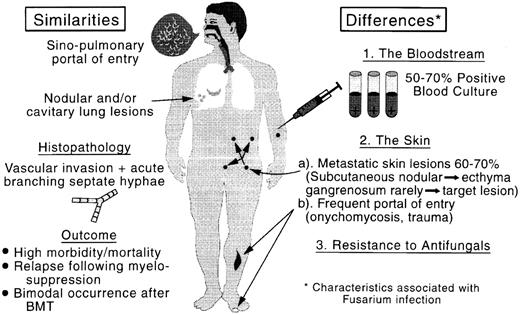 Fig. 4. Comparison of the clinicopathologic features of aspergillosis and fusariosis. BMT, bone marrow transplant.