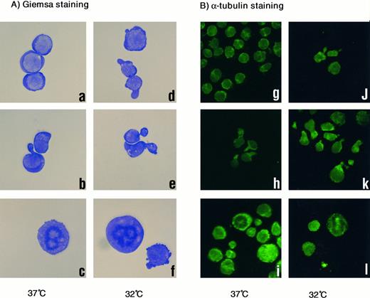 Fig. 4. (A) Giemsa staining of 1-2-3 cells. (a and d) No treatment at 37°C and 32°C; (b and e) treated with vincristine at 37°C and 32°C; and (c and f ) treated with Taxol at 37°C and 32°C. Cells were photographed at 200× magnification. (B) α-Tubulin staining. (g and j) No treatment at 37°C and 32°C; (h and k) treated with vincristine at 37°C and 32°C; (i and l) treated with Taxol at 37°C and 32°C. Cells were photographed at 100× magnification.