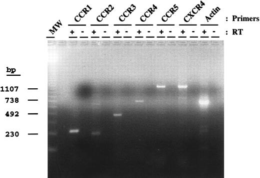 Fig. 4. Chemokine receptor RNA expression by DC. Equivalent amounts of DNase-treated RNA before (−) and after (+) RT were used as a template for PCR using primers specific for the indicated chemokine receptors. PCR products for CCR1 (272 bp), CCR2 (230 bp), CCR3 (444 bp), CCR4 (688 bp), CCR5 (1,117 bp), fusin (1,050 bp), and actin (658 bp) are shown. Molecular weight markers (MW) and their size in basepairs are indicated on the left.