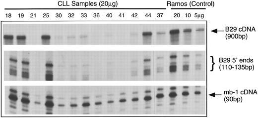 Fig. 2. Analyses of B29 and mb-1 mRNA expression in B-CLL cell samples using simultaneous RPA. Antisense riboprobes were hybridized with total cellular RNA samples from B-CLL cells samples (20 μg/lane) and from control Ramos B cells (5, 10, and 20 μg/lane), RNAse-digested, and analyzed in gels. RNAse protected probe fragments corresponding to the majority of the B29 mRNA coding sequence (900 bp), the multiple 5′ B29 mRNA termini (110 to 135 bp), and an internal mb-1 coding region segment (90 bp) are displayed for 14 representative B-CLL cell samples and the Ramos controls.