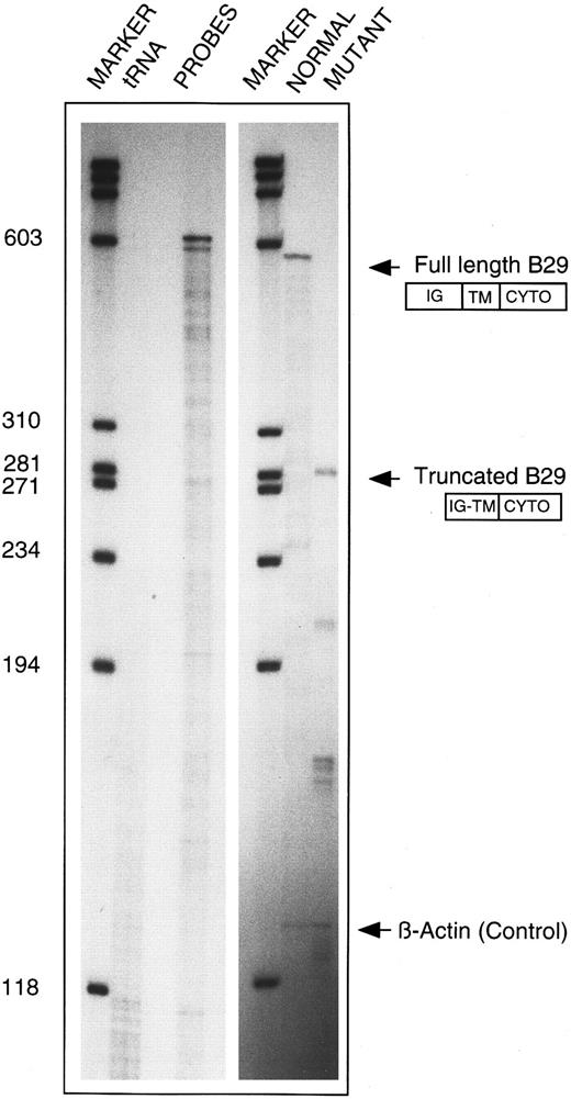 Fig. 4. Confirmation of internally deleted variant B29 mRNA in B-CLL 19 cells. Total cellular RNA samples from patient CLL 19 (10 μg each) were independently reacted with an antisense riboprobe for either wild-type B29 mRNA (ie, 630-nt long) or for the internally deleted variant B29 mRNA cloned from this patient (ie, 588-nt long) and analyzed in RPA. Lanes (left to right) 1 and 4, molecular weight markers; lane 2, control of both riboprobes digested with tRNA; lane 3, undigested wild-type (630 nt) and variant (588 nt) B29 riboprobes; lane 5, protected RPA product obtained with wild-type (630 nt) B29 riboprobe; lane 6, protected RPA products obtained with internally deleted CLL 19 variant (588 nt) B29 riboprobe. β-Actin riboprobe digestion products are shown in lanes 5 and 6 to confirm equivalent RNA inputs.