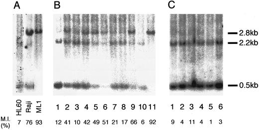 Fig. 2. Southern blotting of the p15INK4B gene. (A) Results of cell lines are shown. The p15INK4B gene was intensively methylated in ML1 and partially methylated in Raji, but not in HL60. (B) Results from patients with various types of MDS are shown. Lane 1, OL (patient no. 4); lane 2, OL (patient no. 29); lane 3, RAEB (patient no. 29); lane 4, RA (patient no. 16); lane 5, RAEB (patient no. 2); lane 6, RA (patient no. 2); lane 7, RAEB (patient no. 21); lane 8, RAEB (patient no. 8); lane 9, OL (patient no. 23). Lanes 10 and 11 show the results of control B lymphocytes digested with both HindIII and Eco52I and with HindIII alone, respectively. Although lanes 10 and 11 contained the same amount of DNA extracted from the same samples, the 2.2-kb band was weaker than the 2.8-kb band. Lanes 2 and 3 and lanes 5 and 6 show the results at different stages in the same patients, respectively. Lanes 2, 4, 5, 6, and 9 retained the 2.8-kb band, implying methylation of the p15INK4B gene. (C) DNA samples from healthy volunteers (lanes 1 through 3) and patients with RA or RARS (lane 4, RARS patient no. 6; lane 5, RA patient no. 10; lane 6, RARS patient no. 20) were almost completely digested by the methylation-sensitive restriction enzyme Eco52I, implying the unmethylated status of their p15INK4B genes. We did not detect altered size of a cross-hybridizing fragment of the p15INK4B gene reported previously.1216