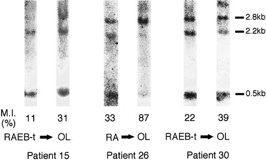 Fig. 6. Intensive hypermethylation of the p15INK4B gene associated with the development of MDS. Changes of the methylation status of the p15INK4B gene in patients no. 15, 26, and 30 are shown. Because the 2.8-kb band was intensified or the 2.2-kb band was faint compared with those at initial analysis in these patients, hypermethylation of the p15INK4B gene may have progressed with the development of MDS.