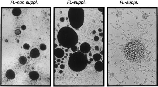 Fig. 2. Microscopic appearance of 10-day cultures. CD34+ CB cells were cultured in TGF-β1 plus GM-CSF, TNFα, and SCF supplemented serum-free medium (left) or in identical medium additionally containing FL (center and right) as described in the Materials and Methods. Representative phase contrast microscopic appearance of cells at low power (original magnification × 20 for left and center panels) or high power (original magnification × 40 for right panel) view is shown.
