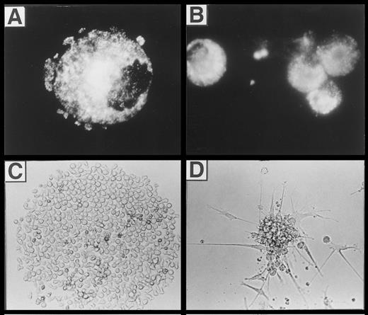 Fig. 8. (A) Fluorescence microscopic appearance of Lag staining in a representative cell generated in the presence of FL plus TGF-β1, GM-CSF, TNFα, and SCF (see the Materials and Methods). (B, C, and D) Microscopic appearance of cells generated from singly seeded CD34+ cells. Purified CD34+ cells (obtained by immunomagnetic isolation, see the Materials and Methods) were sorted individually into 96-well plates using a FACSVantage and cultured in serum-free medium in the presence of FL, GM-CSF, TNFα, and SCF, with or without TGF-β1 for 10 days (see the Materials and Methods). The typical microscopic appearance of colonies is shown. (C) CFC classified as greater than 50 cells/colony (see also Fig 9) generated in the absence of TGF-β1. (D) DC colonies generated in the presence of TGF-β1 (see also Fig 9). (B) Immunofluorescence microphotography showing Lag expression of individually harvested CFU-DC.