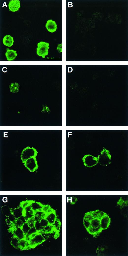 Fig. 4. CD34 is detected on cells from both wild-type and scl-null EBs but only wild-type EBs contain cells positive for globin or GATA-1. Indirect immunofluorescence of cells from disaggregated day-12 scl+/+ (A, C, E, and F ) and scl-null (B, D, F, and H) EBs stained with antibodies to globin (A and B), GATA-1 (C and D), and CD34 (E through H).